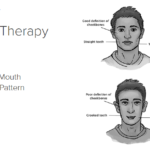 four goals of myofunctional therapy