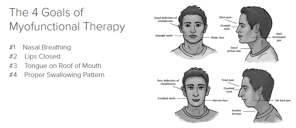 four goals of myofunctional therapy